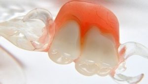 mikroproteza-z-akronu